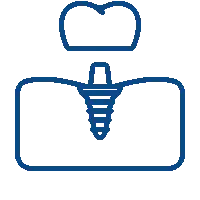 Dental Implants Dental Implants
